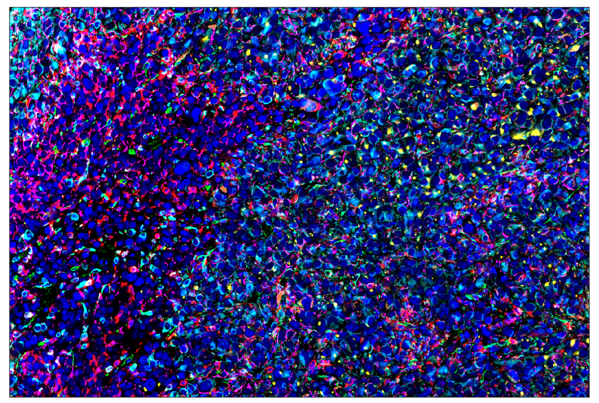 Immunohistochemistry Image 1: CD206/MRC1 (E6T5J) & CO-0032-647 SignalStar™ Oligo-Antibody Pair
