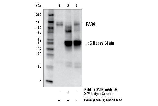 Immunoprecipitation Image 1: PARG (E9R4G) Rabbit mAb