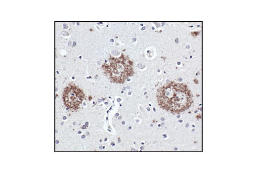 Immunohistochemistry Image 1: APP/β-Amyloid (NAB228) Mouse mAb