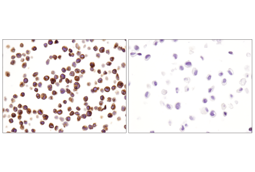Immunohistochemistry Image 6: CD3ε (D7A6E™) XP® Rabbit mAb (BSA and Azide Free)