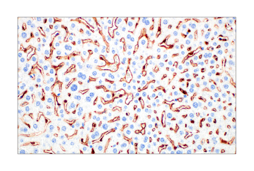  Image 21: Mouse Reactive M1 vs M2 Macrophage IHC Antibody Sampler Kit
