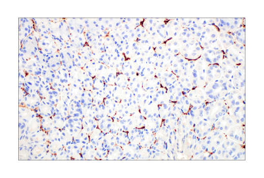  Image 36: Mouse Reactive M1 vs M2 Macrophage IHC Antibody Sampler Kit