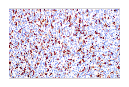  Image 50: Mouse Reactive M1 vs M2 Macrophage IHC Antibody Sampler Kit