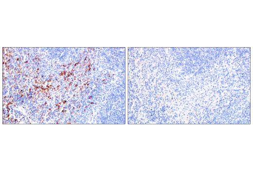  Image 71: Mouse Reactive M1 vs M2 Macrophage IHC Antibody Sampler Kit