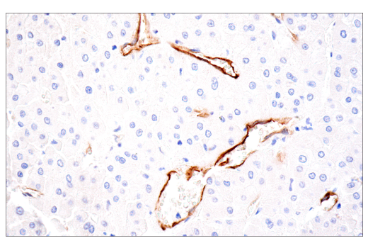 Immunohistochemistry Image 4: CD109 (E4I2V) Rabbit mAb