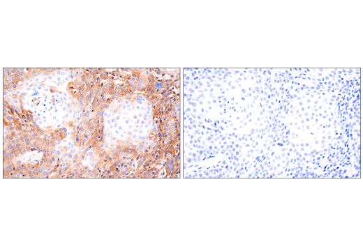 Immunohistochemistry Image 6: CD109 (E4I2V) Rabbit mAb