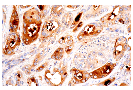 Immunohistochemistry Image 8: CD109 (E4I2V) Rabbit mAb