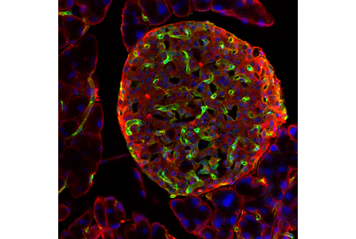 Immunofluorescence Image 1: VEGF Receptor 2 (55B11) Rabbit mAb