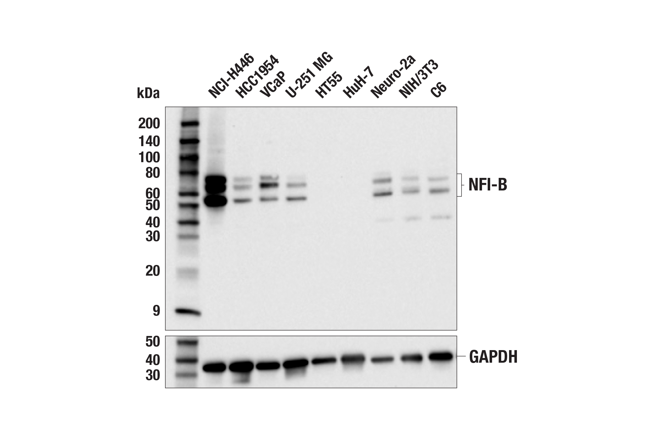 NFI-B (E5L7U) Rabbit MAb | Cell Signaling Technology