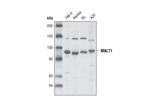 Western Blotting Image 1: MALT1 Antibody