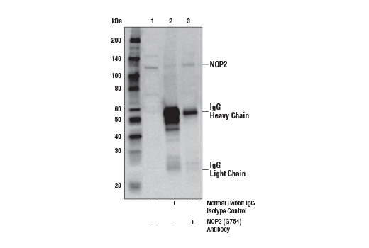 Immunoprecipitation Image 1: NOP2 (G754) Antibody