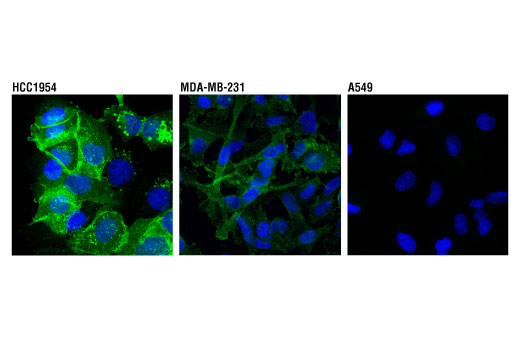Immunofluorescence Image 1: PD-L1 (Extracellular Domain Specific) (D8T4X) Rabbit mAb (Alexa Fluor® 488 Conjugate)