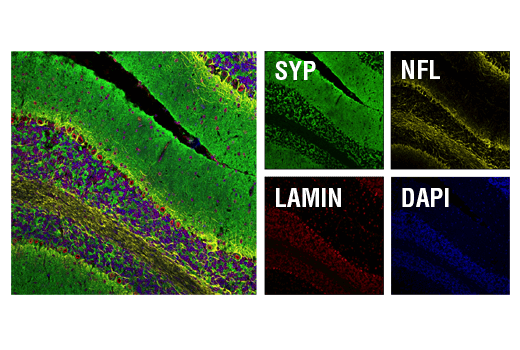 Immunofluorescence Image 2: Synaptophysin (D8F6H) XP® Rabbit mAb (BSA and Azide Free)