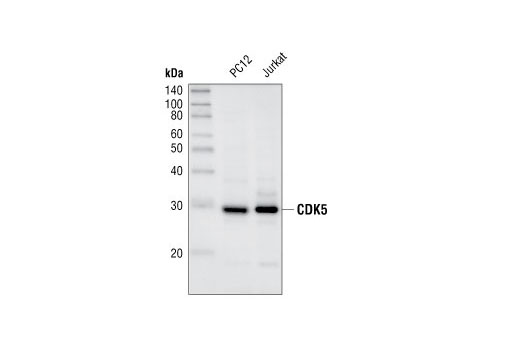 Western Blotting Image 1: CDK5 Antibody