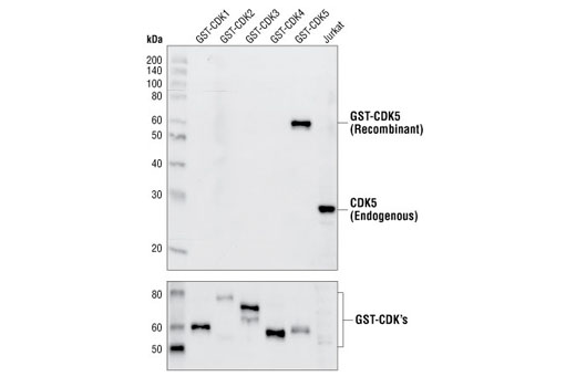 Western Blotting Image 2: CDK5 Antibody