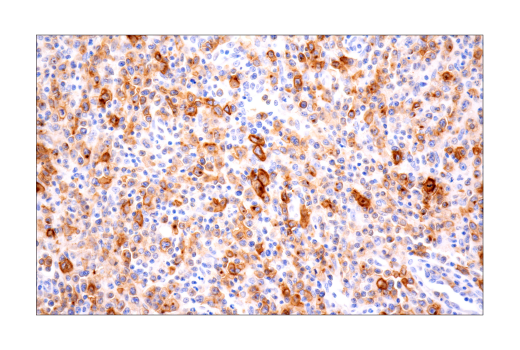 Immunohistochemistry Image 7: TNFRSF8/CD30 (E7E4D) XP® Rabbit mAb