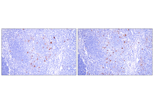 Immunohistochemistry Image 9: TNFRSF8/CD30 (E7E4D) XP® Rabbit mAb