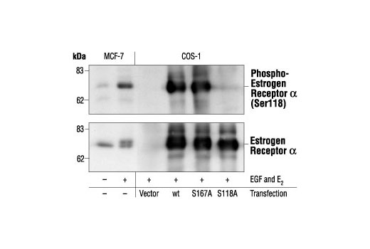  Image 2: Phospho-Estrogen Receptor α Antibody Sampler Kit