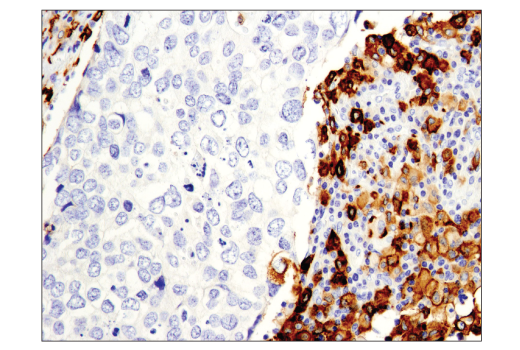 Immunohistochemistry Image 2: CD163 (D6U1J) Rabbit mAb (BSA and Azide Free)
