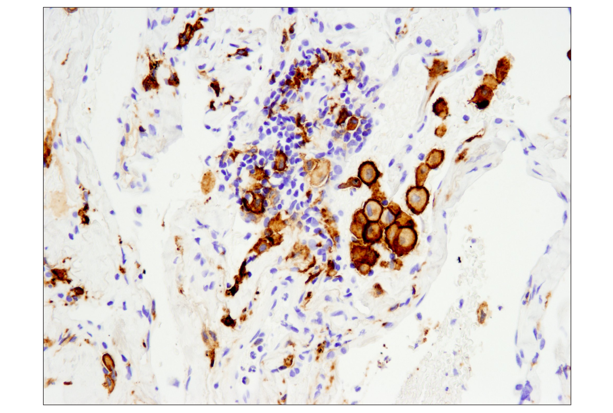 Immunohistochemistry Image 1: CD163 (D6U1J) Rabbit mAb (BSA and Azide Free)