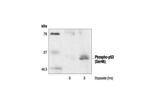 Immunoprecipitation Image 1: Phospho-p53 (Ser46) Antibody