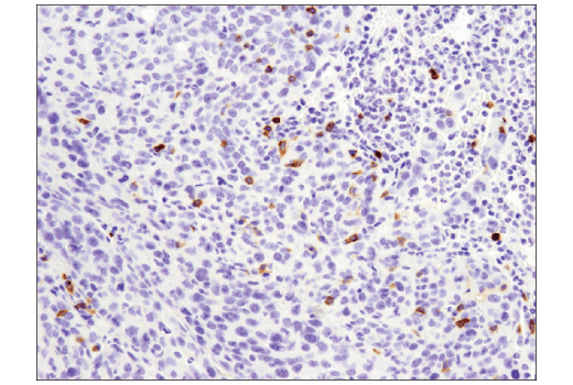 Immunohistochemistry Image 1: CD4 (D7D2Z) Rabbit mAb