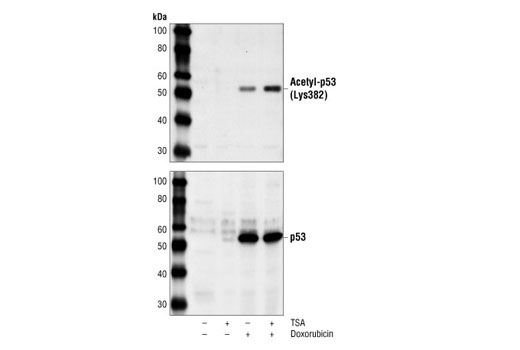 Western Blotting Image 2: Acetyl-p53 (Lys382) Antibody