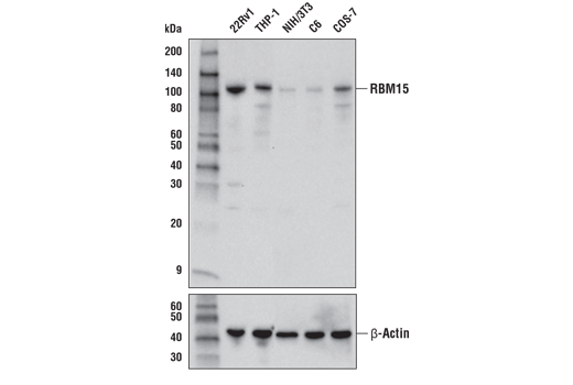 Western Blotting Image 1: RBM15 Antibody