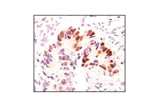 Immunohistochemistry Image 2: Phospho-p53 (Ser33) Antibody