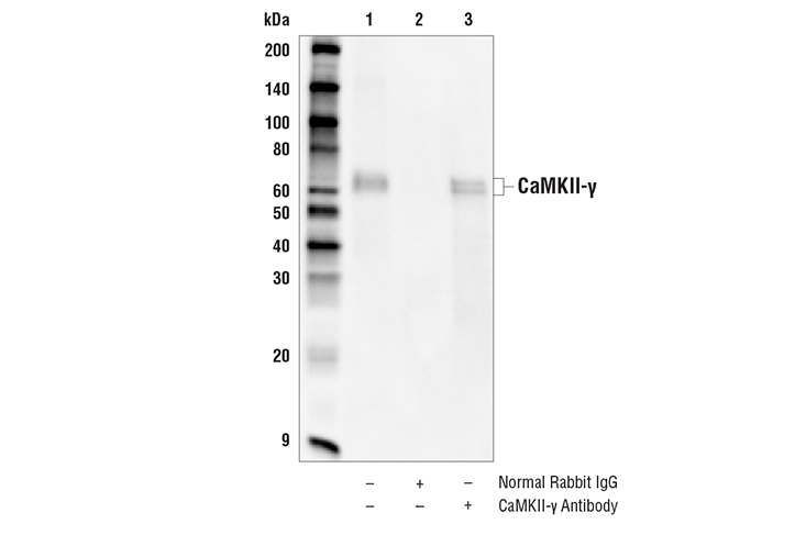 Immunoprecipitation Image 1: CaMKII-γ Antibody