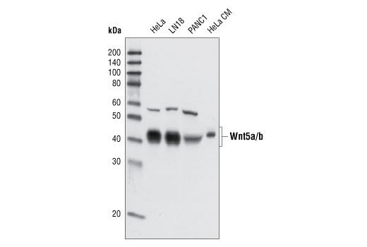  Image 4: Wnt Signaling Antibody Sampler Kit