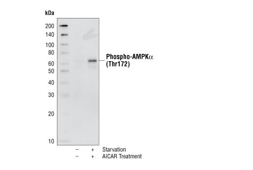 Western Blotting Image 1: Phospho-AMPKα (Thr172) Antibody