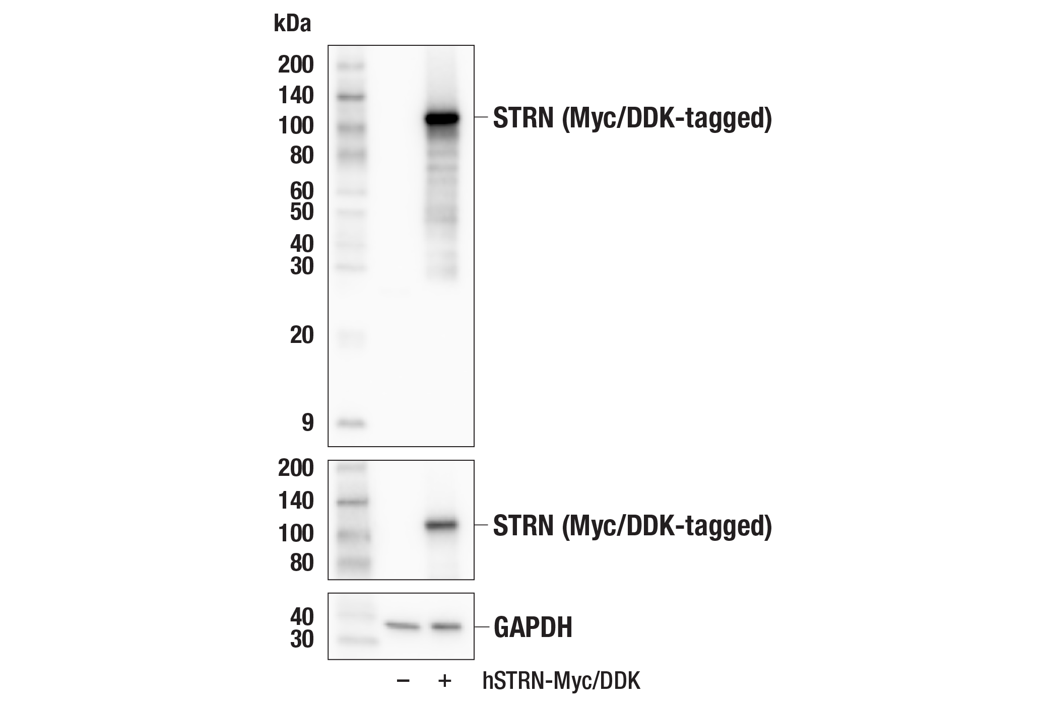 STRN (E6E3N) Rabbit MAb | Cell Signaling Technology