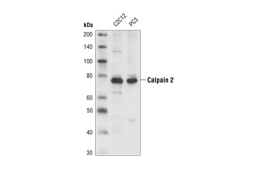 Western Blotting Image 1: Calpain 2 Large Subunit (M-type) Antibody