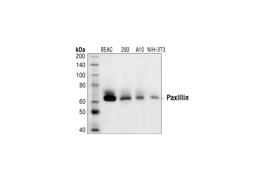 Western Blotting Image 1: Paxillin Antibody