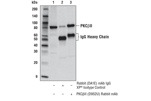 Immunoprecipitation Image 1: PKCβII (D9S2U) Rabbit mAb