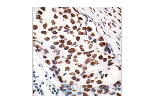  Image 16: Acetyl-Histone Antibody Sampler Kit