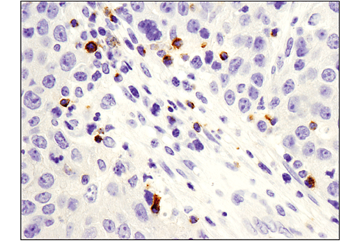 Immunohistochemistry Image 1: LAG3 (D2G4O™) XP® Rabbit mAb (BSA and Azide Free)