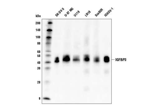  Image 4: YAP/TAZ Transcriptional Targets Antibody Sampler Kit