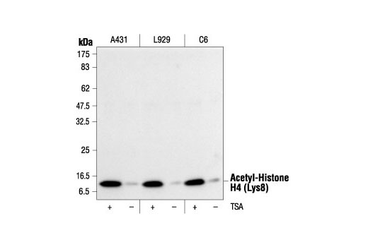  Image 6: Acetyl-Histone Antibody Sampler Kit