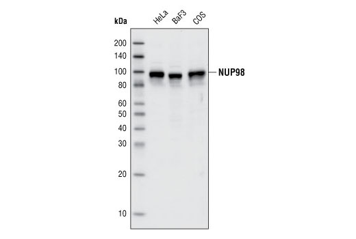  Image 7: Nucleus and Nuclear Envelope-Associated Marker Proteins Antibody Sampler Kit