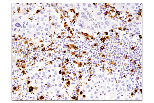 Immunohistochemistry Image 3: CD68 (D4B9C) XP® Rabbit mAb (BSA and Azide Free)