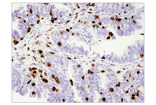 Immunohistochemistry Image 2: CD68 (D4B9C) XP® Rabbit mAb (BSA and Azide Free)