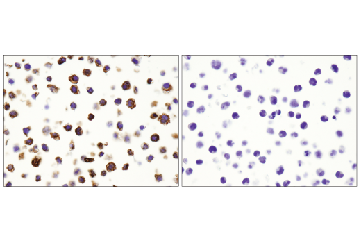 Immunohistochemistry Image 7: CD68 (D4B9C) XP® Rabbit mAb (BSA and Azide Free)