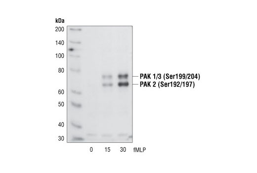  Image 4: PAK 1/2/3 Antibody Sampler Kit