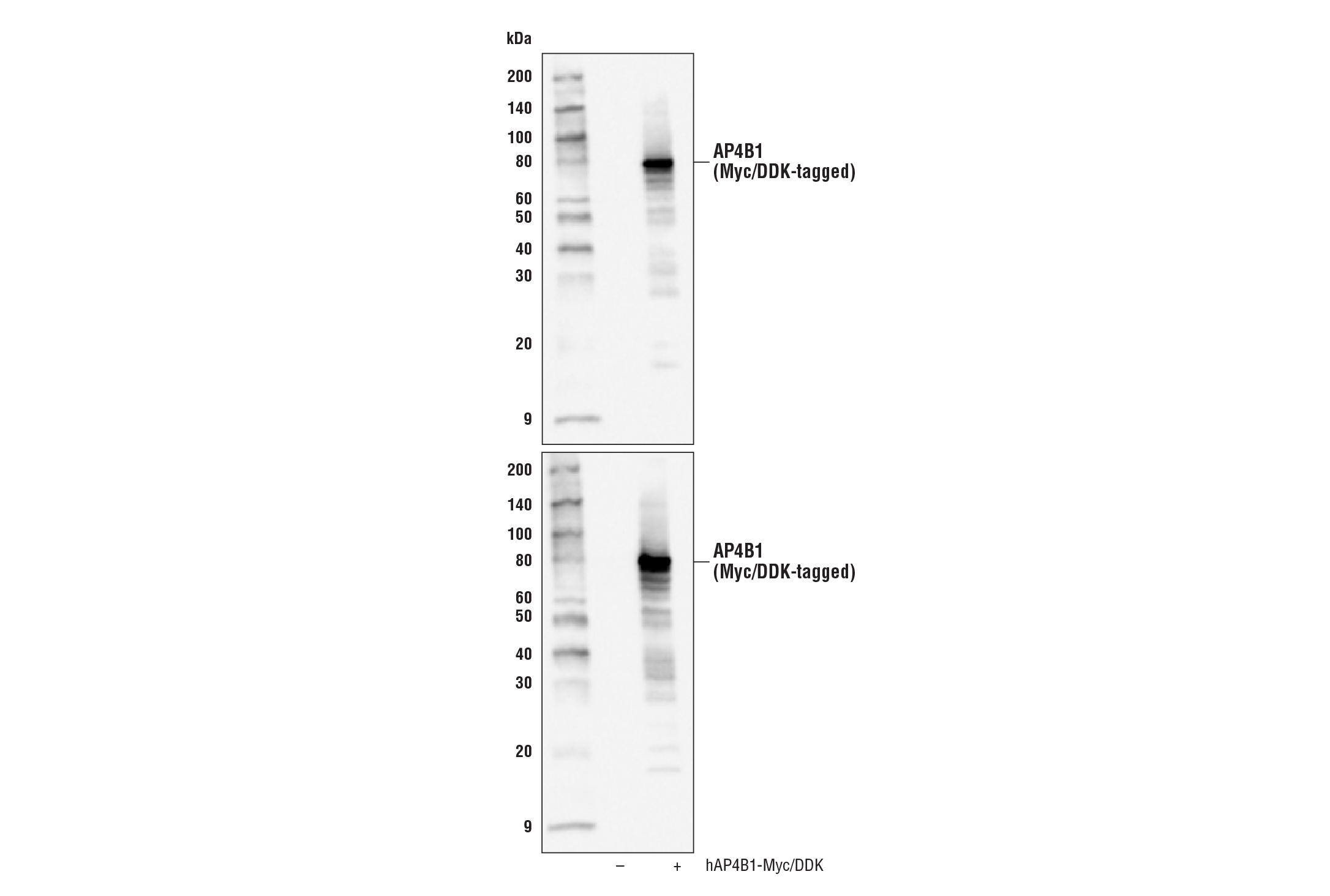 Western Blotting Image 1: AP4B1 Antibody