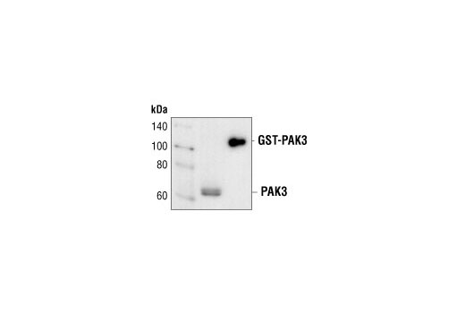 Western Blotting Image 1: PAK3 Antibody