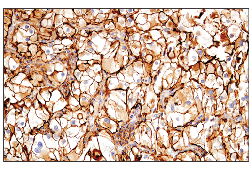 Immunohistochemistry Image 4: CD54/ICAM-1 (E3Q9N) XP® Rabbit mAb (BSA and Azide Free)
