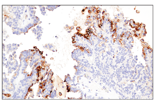 Immunohistochemistry Image 5: CD54/ICAM-1 (E3Q9N) XP® Rabbit mAb (BSA and Azide Free)