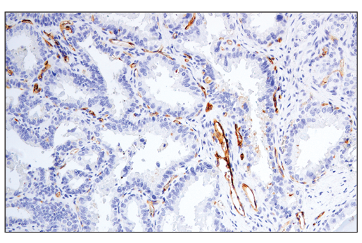 Immunohistochemistry Image 1: CD54/ICAM-1 (E3Q9N) XP® Rabbit mAb (BSA and Azide Free)